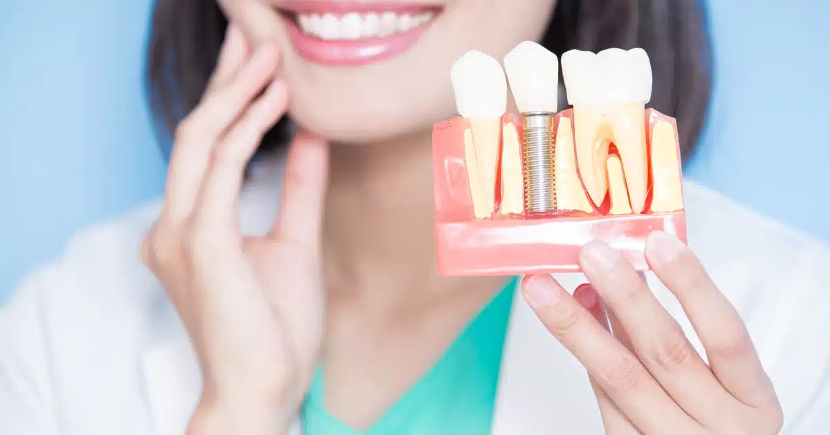 Smiling woman in a lab coat holding a dental model that clearly shows a Dental Implants in Melbourne, FL next to a natural tooth.