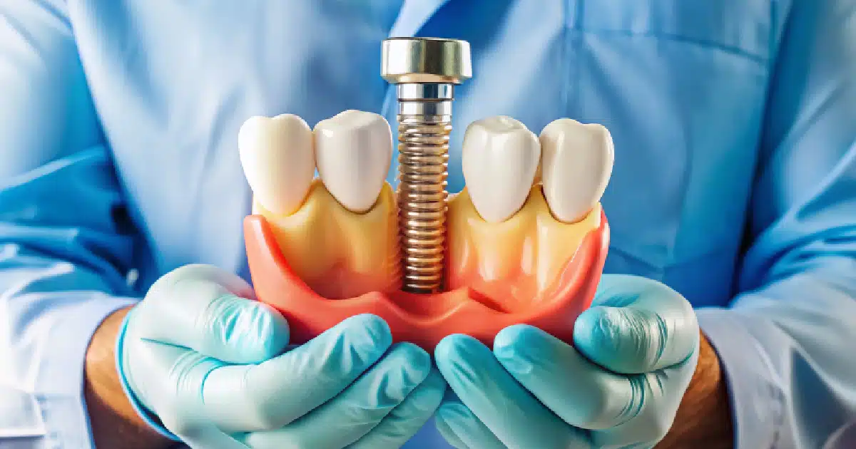 Dental Implant procedure in Melbourne, FL