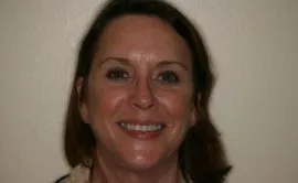 Before Image: Porcelain Crowns (Caps) - front