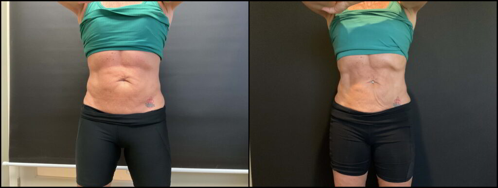 Before and After Image: Wellness - front