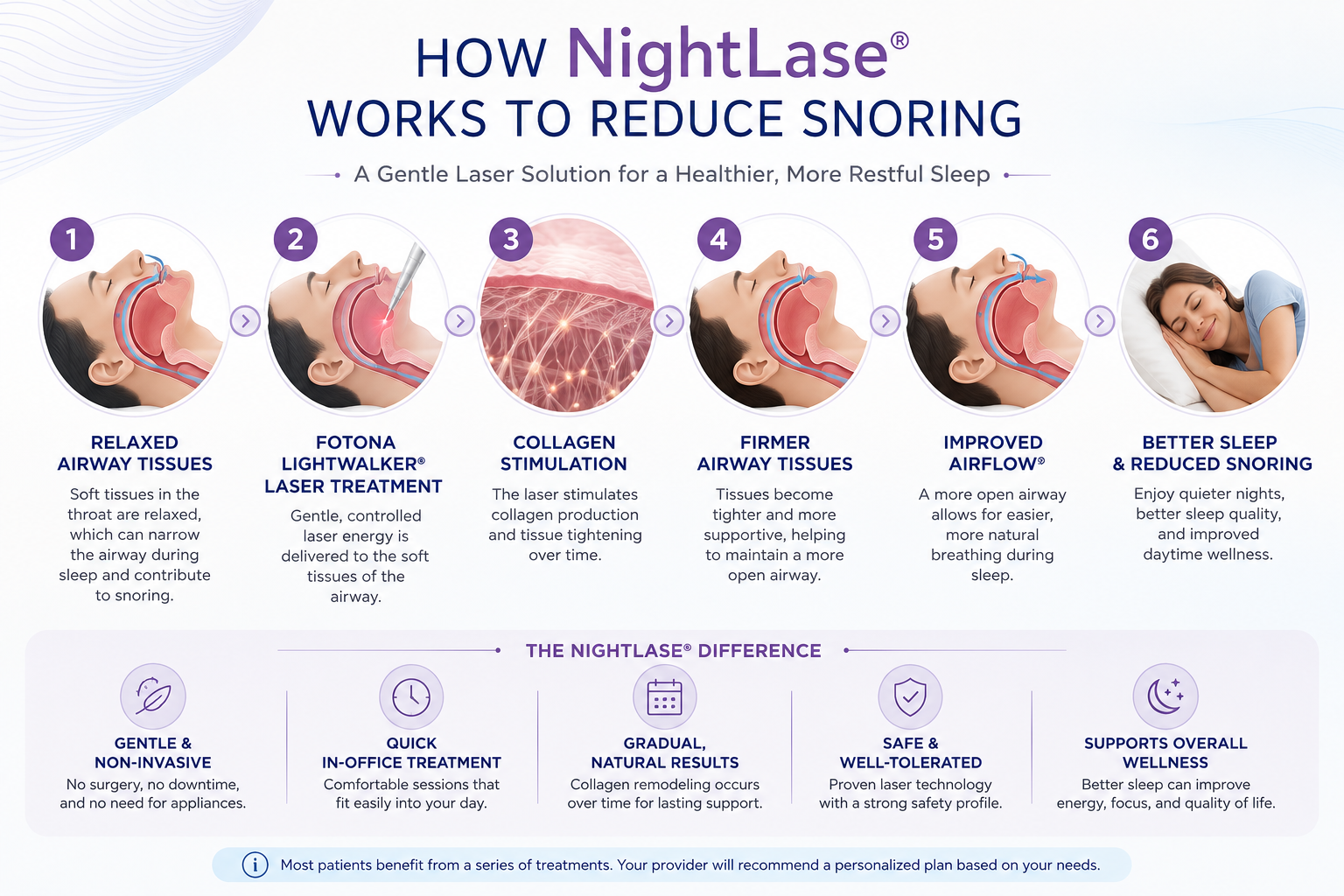 how-nightlase-works-to-reduce-snoring-infographic.jpg How NightLase helps reduce snoring infographic